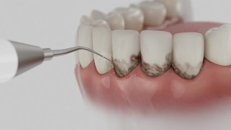 Reliable Dental Implants contractor in Northampton, PA by Smile Center Dentistry